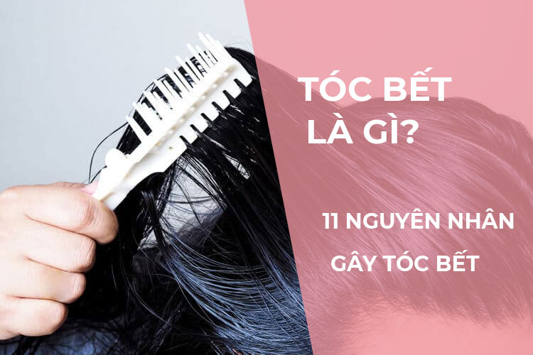 Dịch vụ hỗ trợ chuyên nghiệp